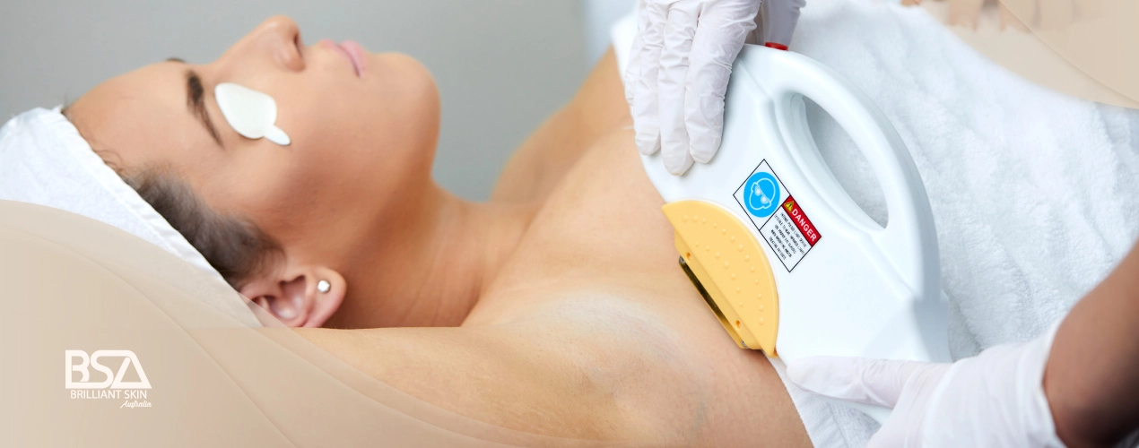 Laser Hair Removal Treatment in Sydney