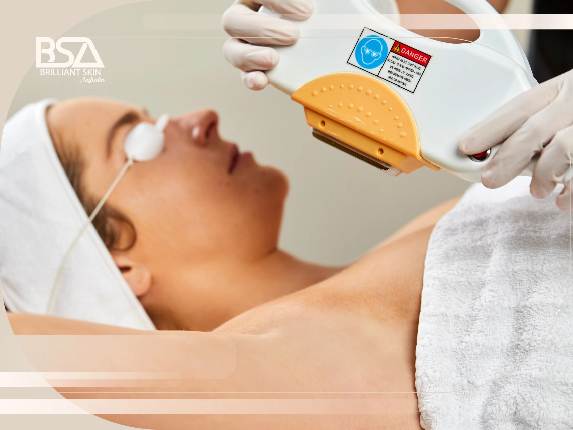 Laser Hair Removal Safety Protocols