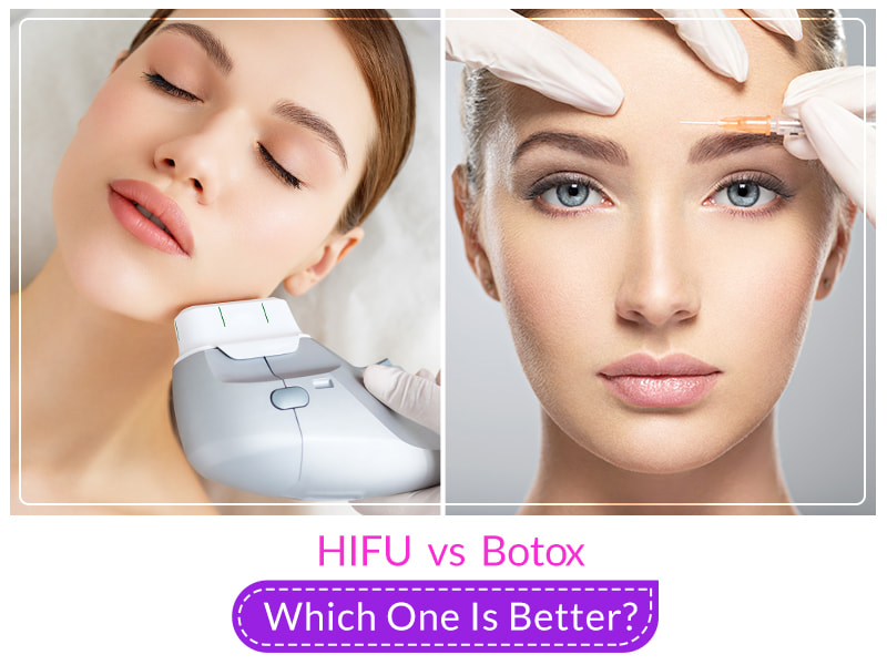 HIFU vs Botox – Which One Is Better?