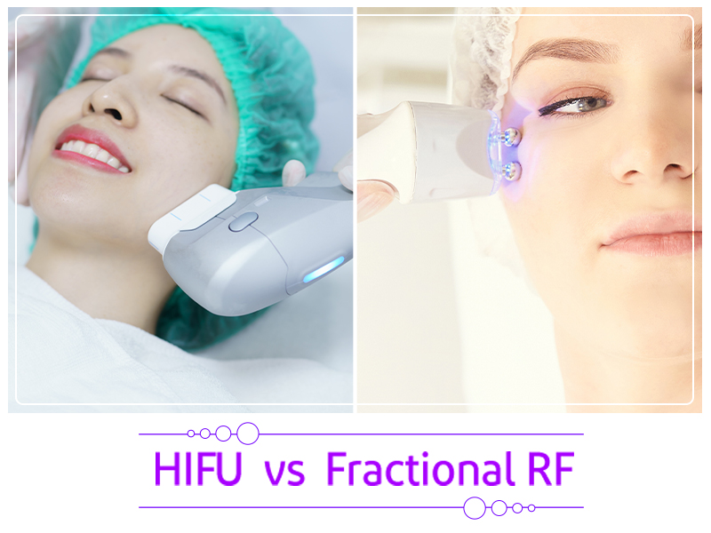 HIFU vs Fractional RF Skin Tightening