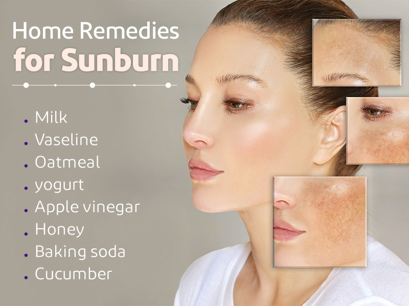 Sunburn Relief: 17 Home Remedies for Sunburns