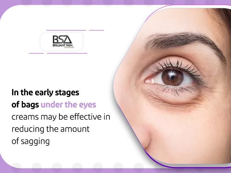 Tips To Reduce Puffy Eyes In The Morning