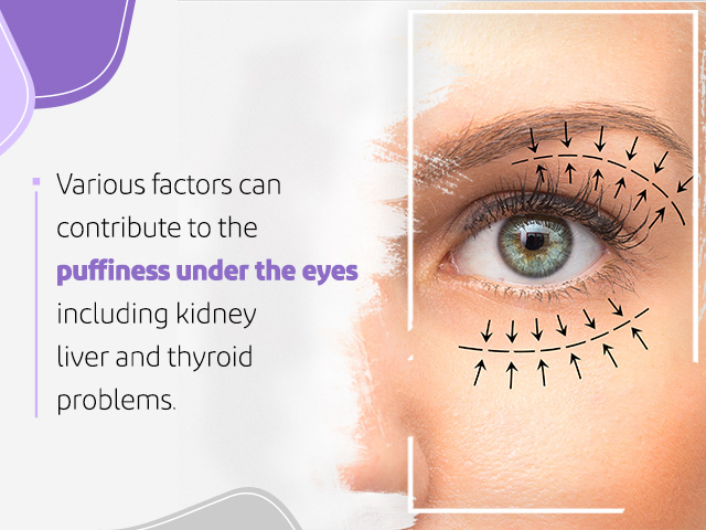 7 causes of puffy eyes and how to treat them