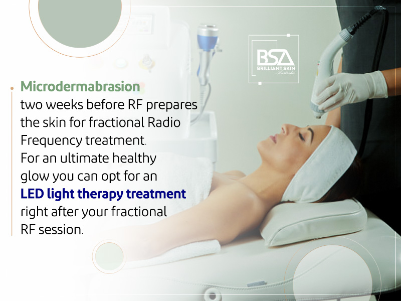 Microdermabrasion two weeks before RF prepares the skin for fractional Radio Frequency