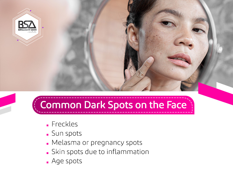 Common Dark Spots on the Face