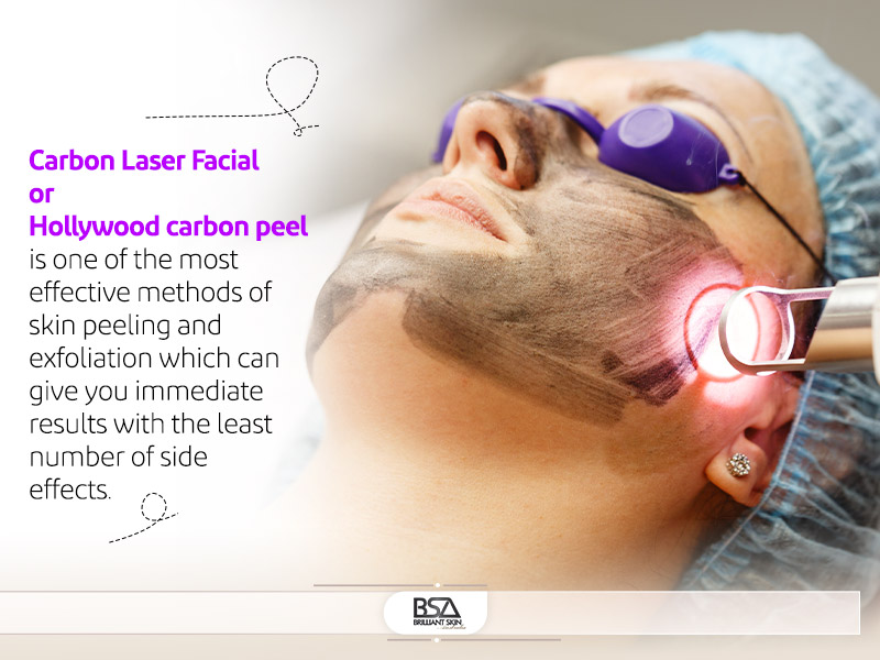 Hollywood carbon peel is one of the most effective methods of skin peeling and exfoliation