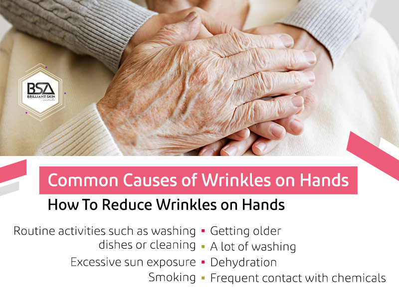 How To Reduce Wrinkles on Hands