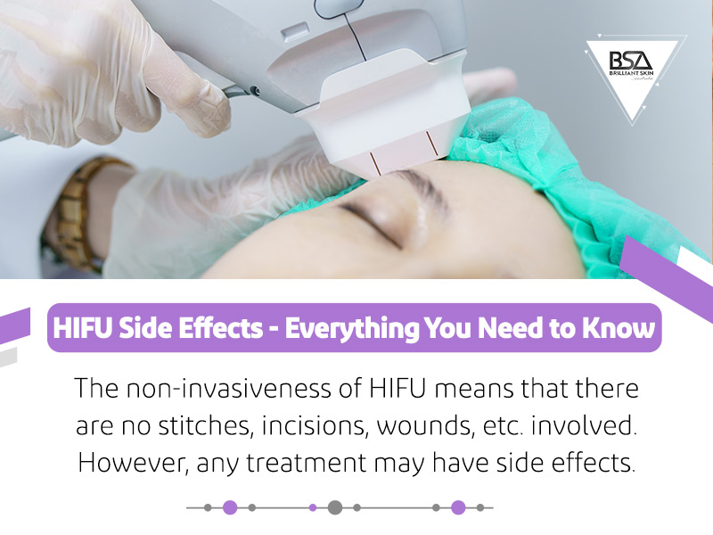 HIFU Side Effects - Everything You Need to Know