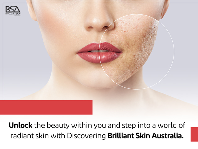 The best photo rejuvenation beauty clinic