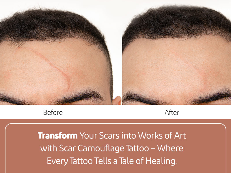 scar camouflage tattoo - PERMANENT MAKE UP NJ | MICROBLADING NEW JERSEY