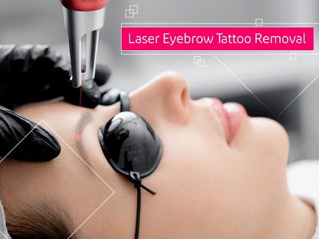 laser Eyebrow Tattoo Removal