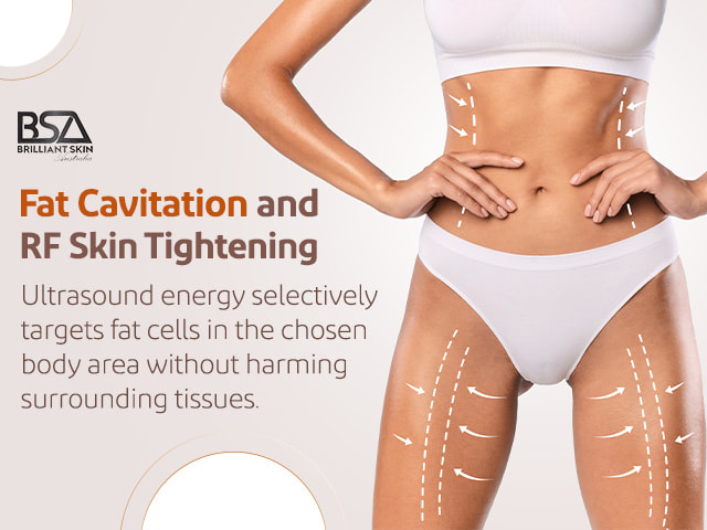 RF BODY CONTOURING – COSMETIC BOUTIQUE AUSTRALIA