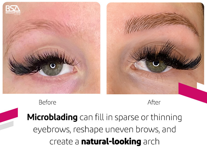 Microblading