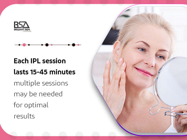 IPL Vascular Therapy  Brilliant Skin Australia