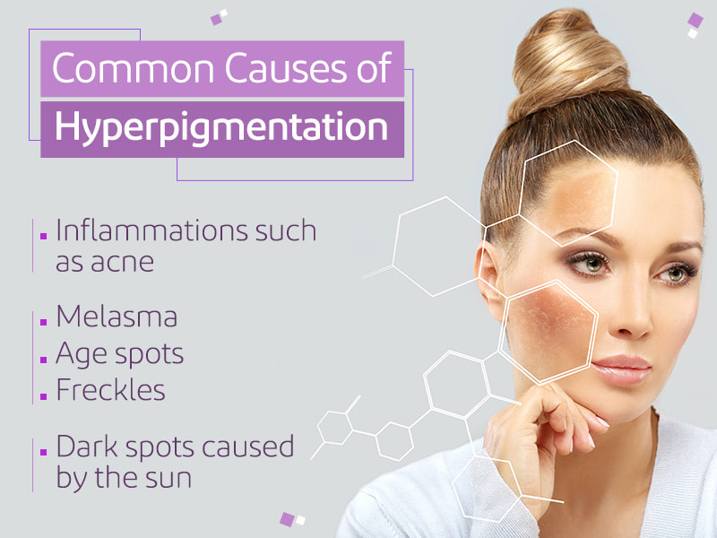 Pigmentation Removal