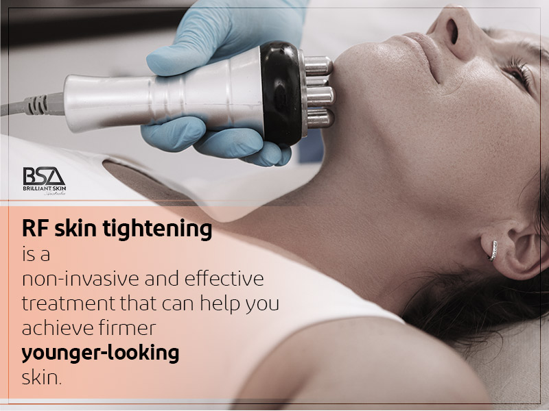 RF Skin Tightening