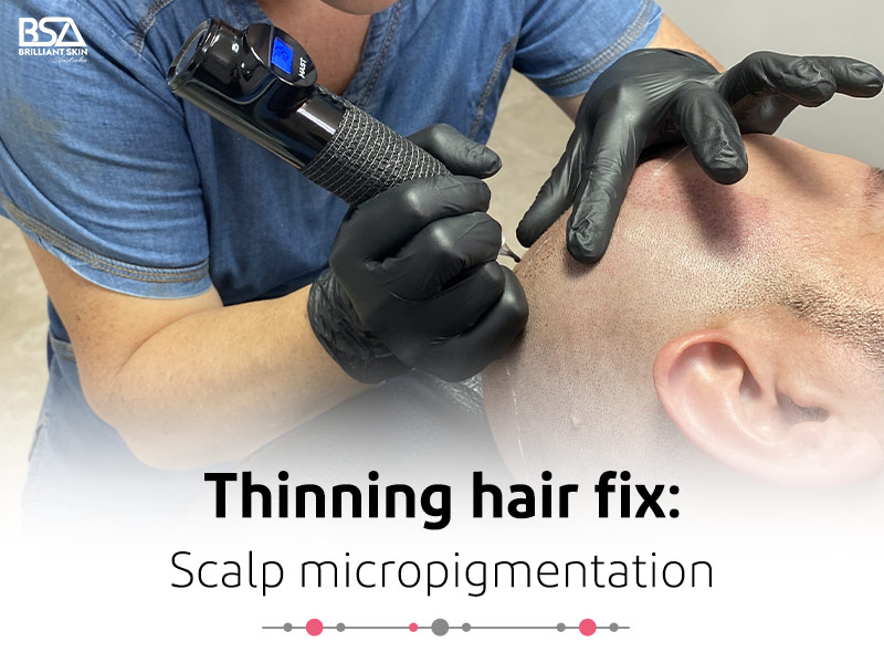 Scalp Micropigmentation for Long Hair