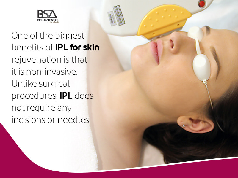 IPL for Skin car