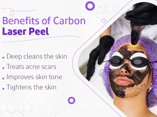 Carbon Laser Peel  Benefits and Side Effects -min