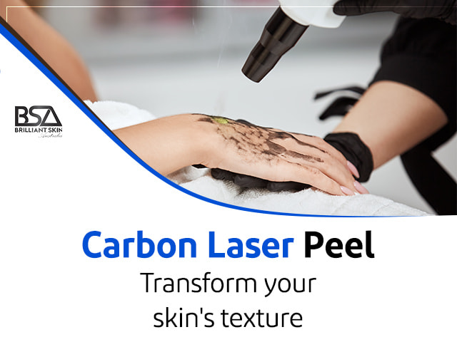 Carbon Laser Peel Side Effects