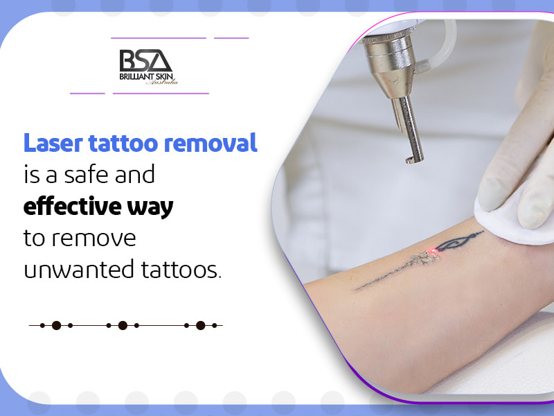 Say goodbye to regretful tattoos 