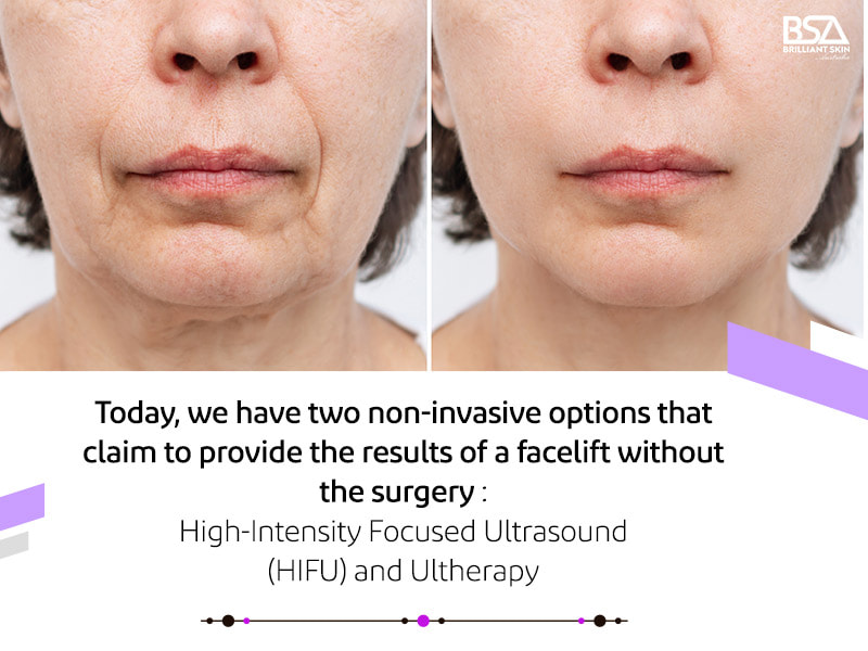 HIFU vs Ultherapy