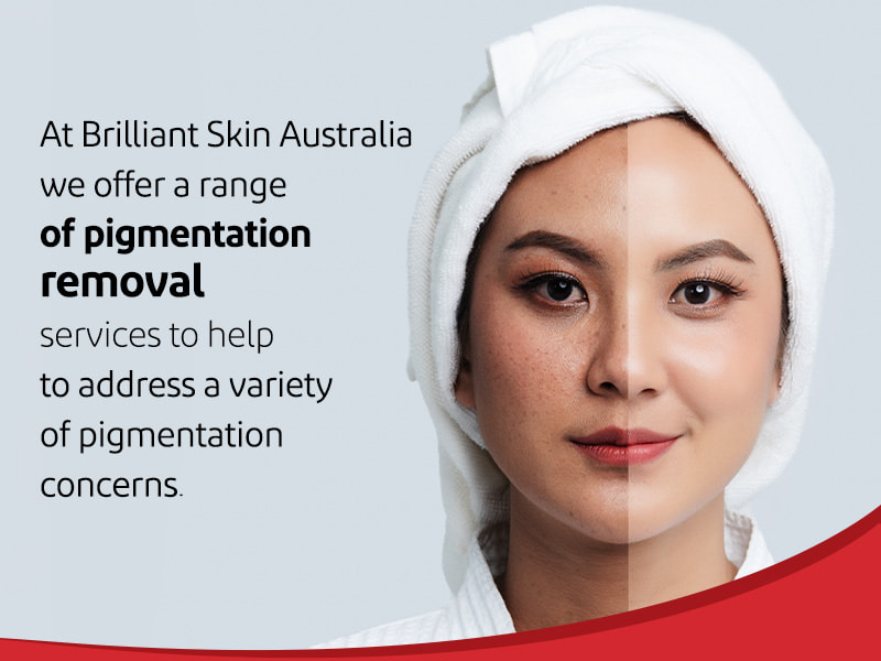 Brilliant Skin Australia's Pigmentation Removal Treatments in Sydney-min