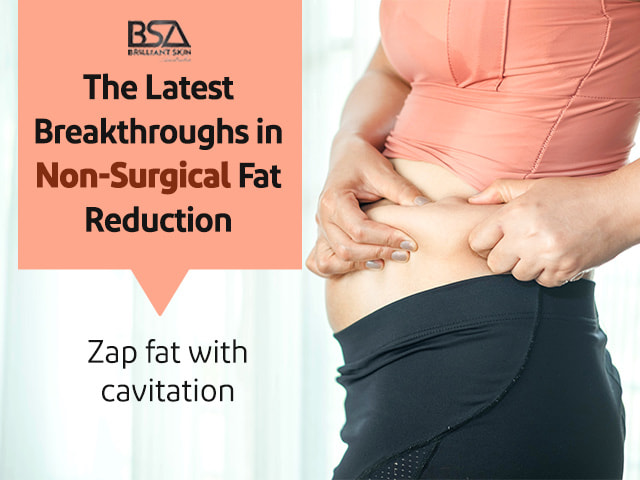 The Latest Breakthroughs in Non-Surgical Fat Reduction