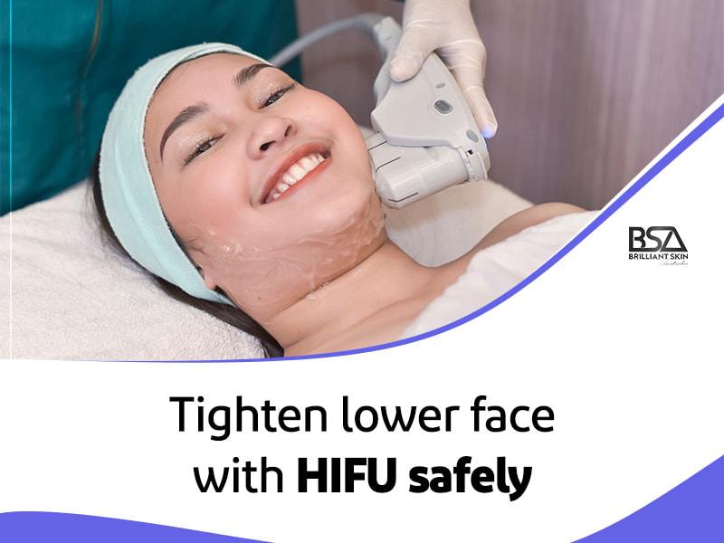 HIFU Lower Face 