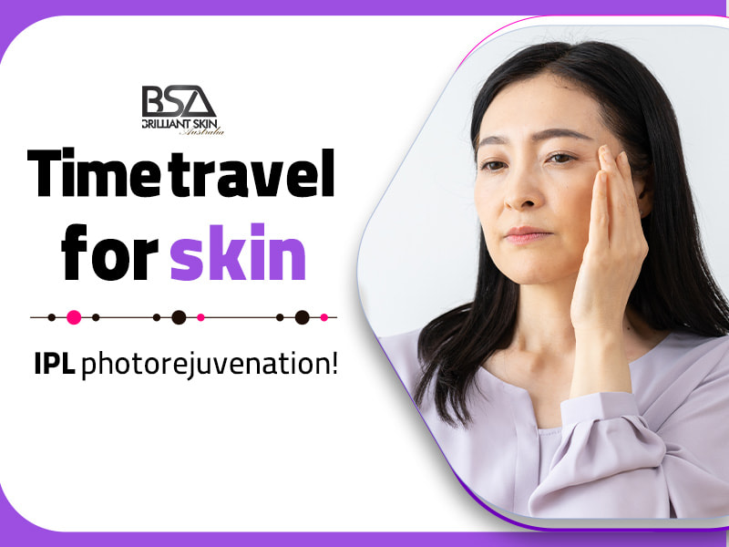 IPL photorejuvenation