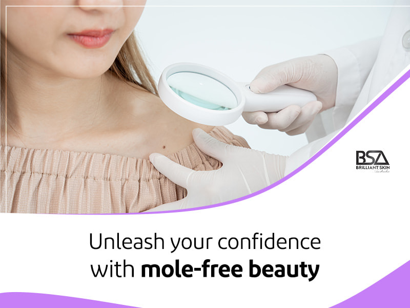 mole removal before and after