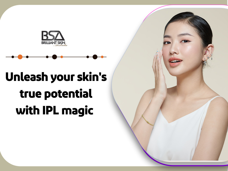 Unleash your skin's true potential with IPL magic