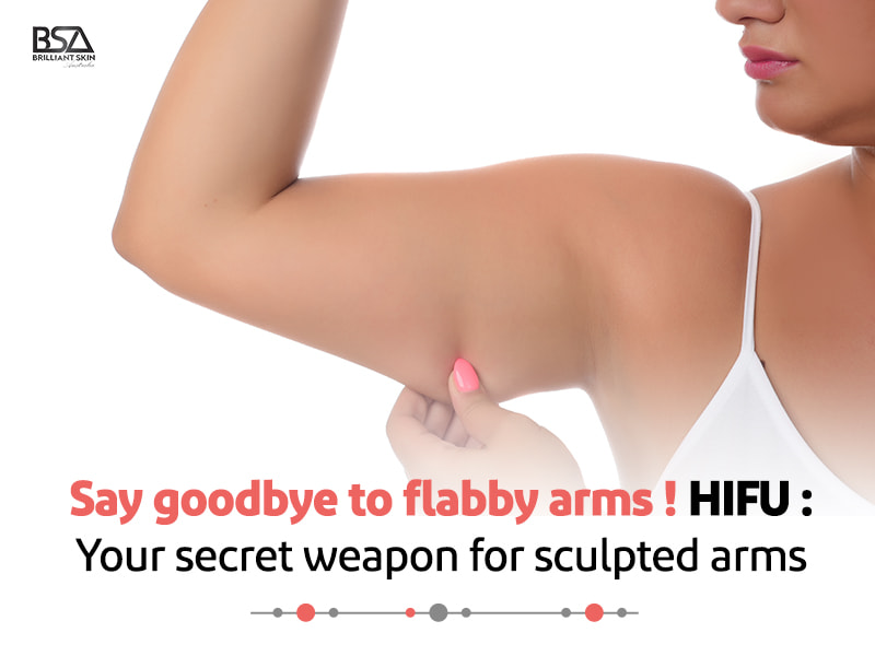 Hifu is the best arm lifting method