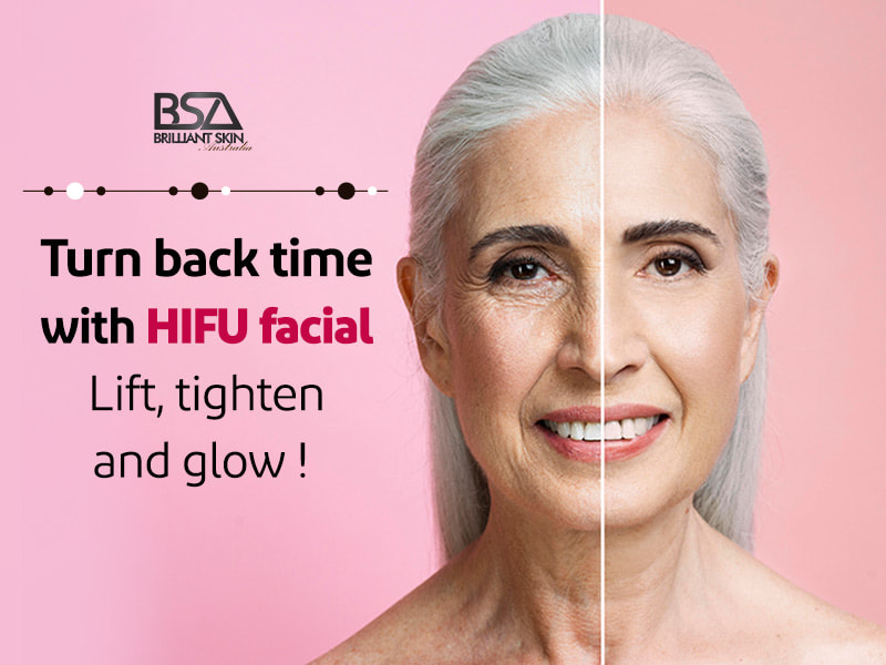 HIFU Facial