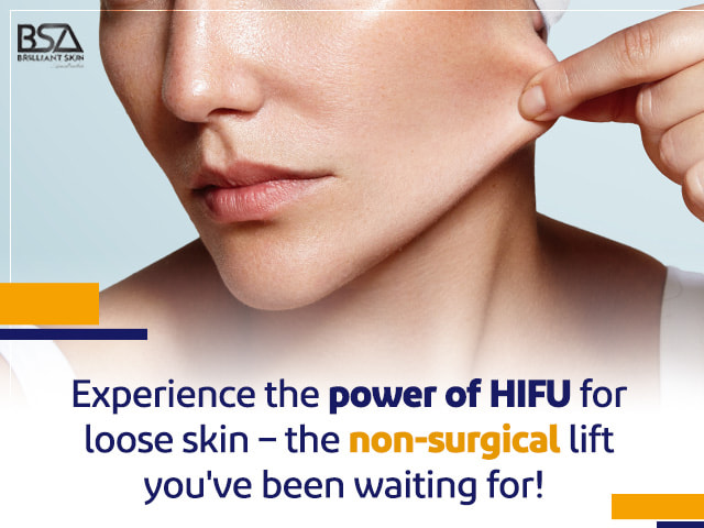 HIFU Treatment for Loose Skin