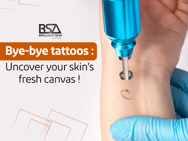Bye-bye tattoos Uncover your skin's fresh canvas!