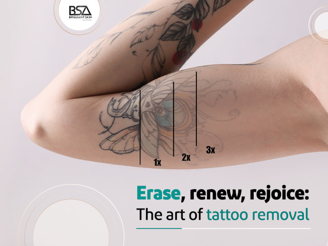 https://www.brilliantskinaustralia.com.au/upload/partspics/1706123605-Erase-renew-rejoice-The-art-of-tattoo-removal.jpg