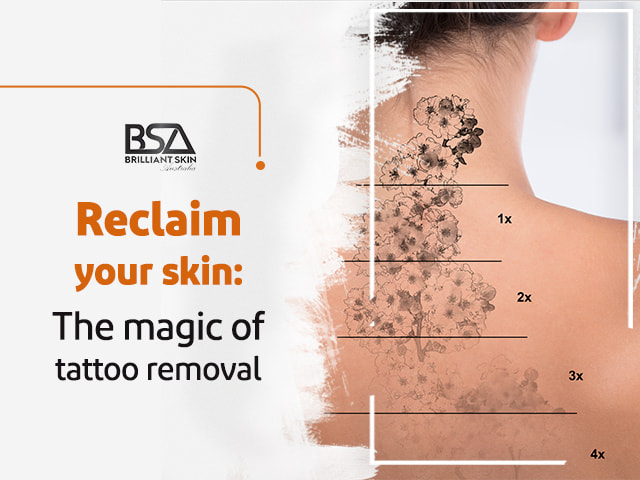 Reclaim your skin The magic of tattoo removal 