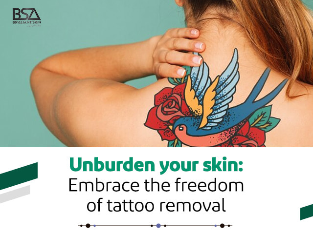 Tattoo Removal in Sydney