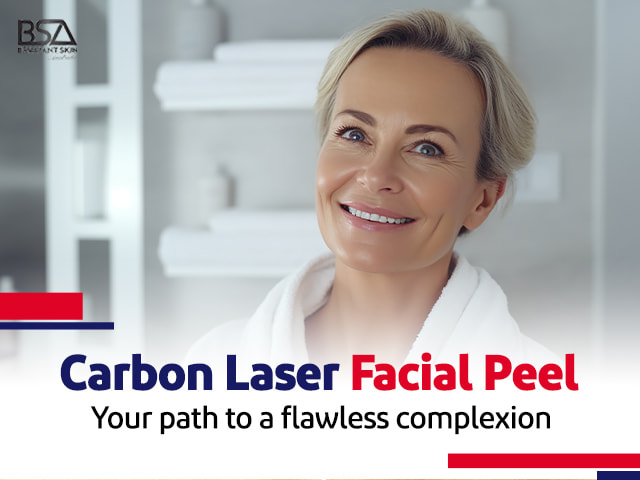 Carbon Laser Peel