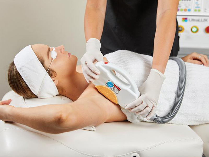 Super Hair Removal (SHR) with UltraLUX