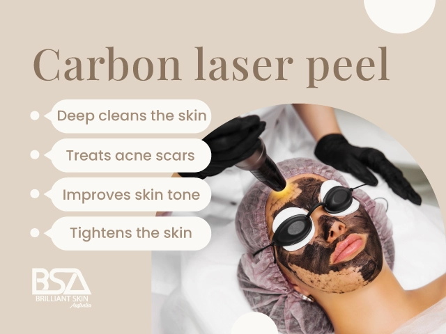 Carbon laser peel treatment deep cleansing and improving skin tone
