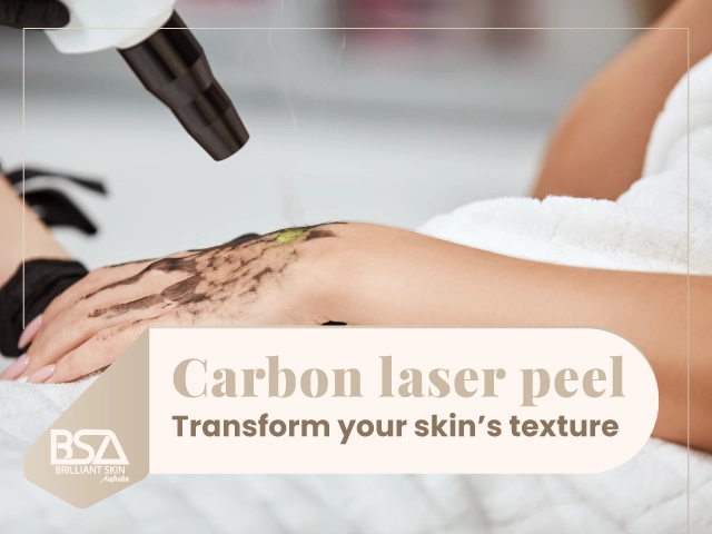 Carbon laser peel applied to hand to improve skin texture
