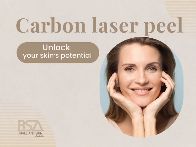 Smiling woman promoting smoother skin after carbon laser peel treatment