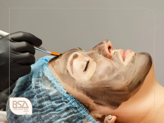 Carbon laser peel mask being applied before laser treatment
