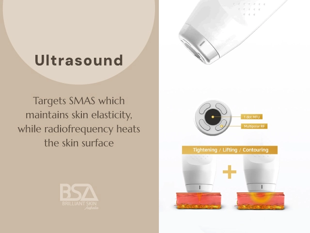 Graphic explaining MFU ultrasound targeting the SMAS layer and RF heating the skin surface for tightening, lifting, and contouring