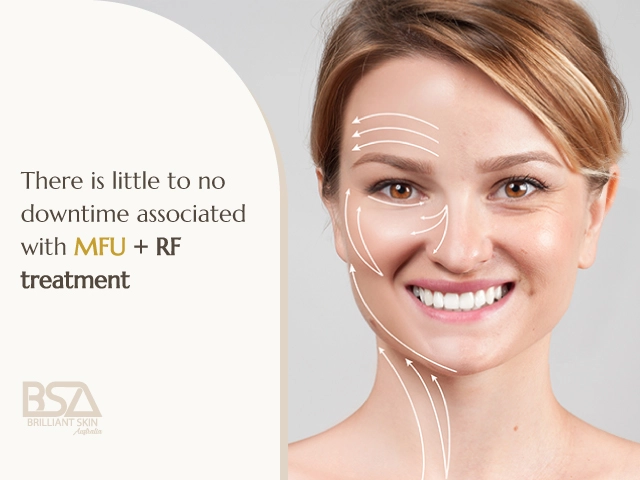 Smiling woman with facial lifting guide lines and text stating little to no downtime with MFU + RF treatment
